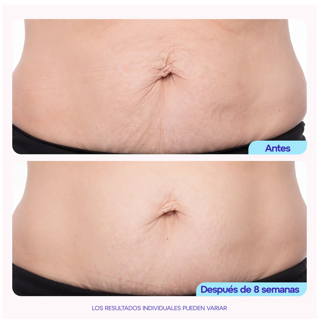 GoPure™️ | Crema para reafirmar y suavizar la panza