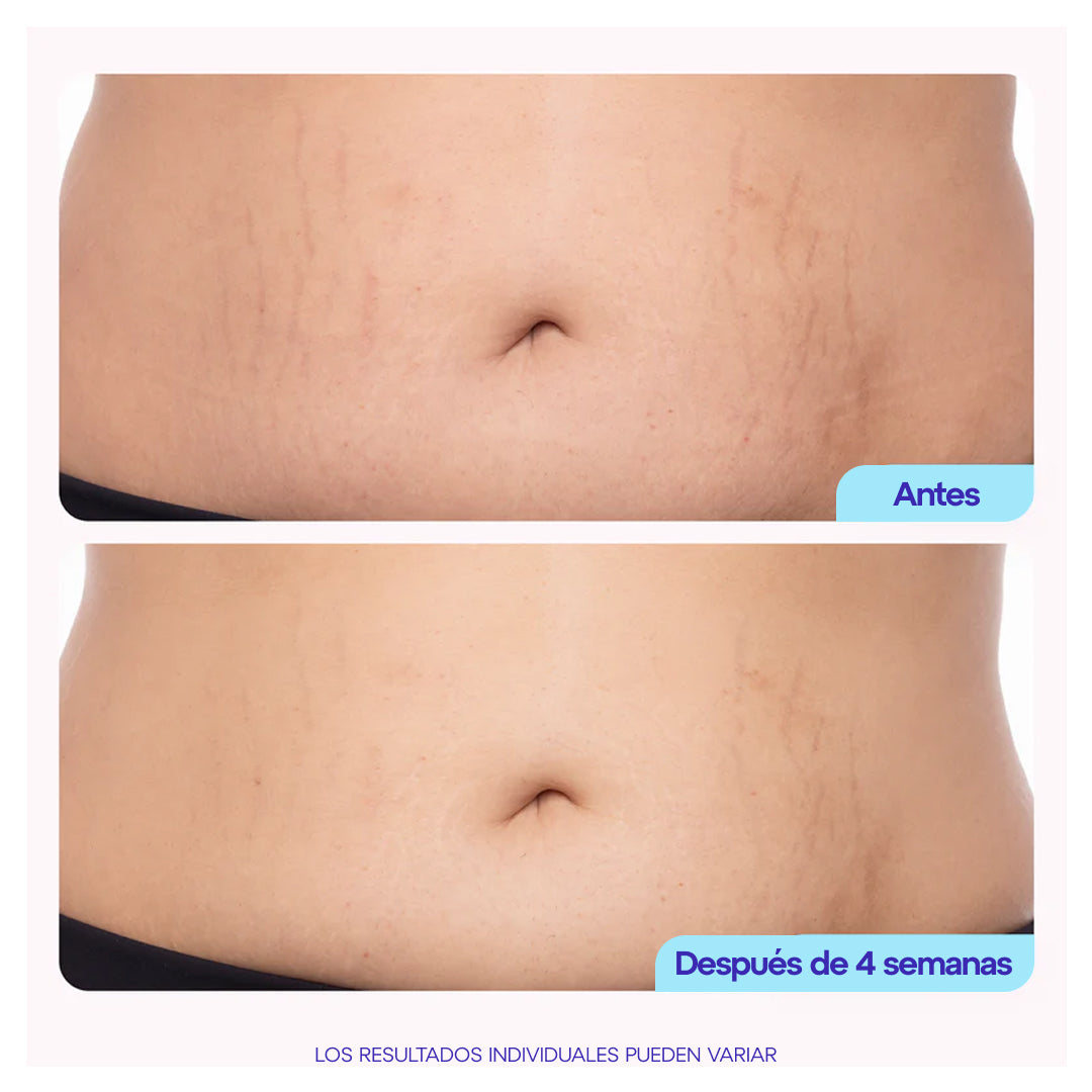 GoPure™️ |  Crema para reafirmar y suavizar la panza